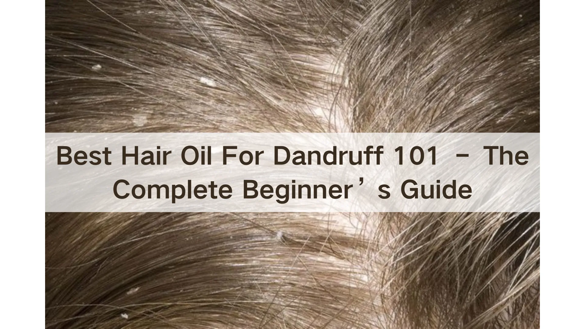 Best Hair Oil For Dandruff 101