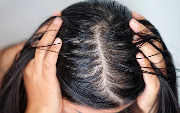 For Oily Scalp