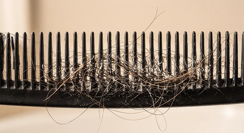 Close-up view of white residue buildup between the teeth of a used hair comb